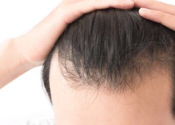Top Hair Loss Treatment Options in Melbourne 1