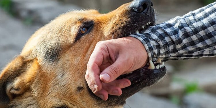 Your Rights After a Dog Bite
