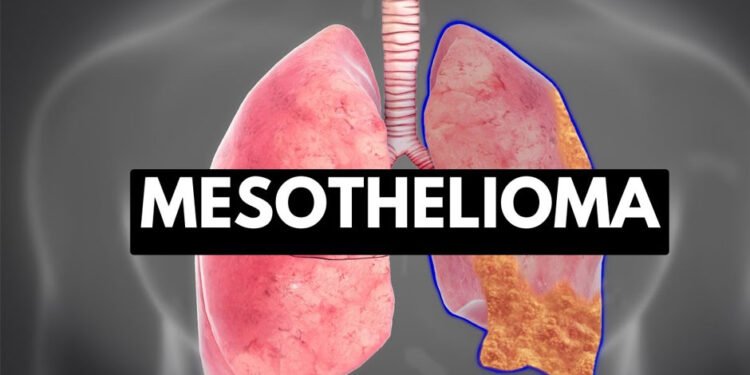 What-You-Should-Know-About-Mesothelioma-Issues