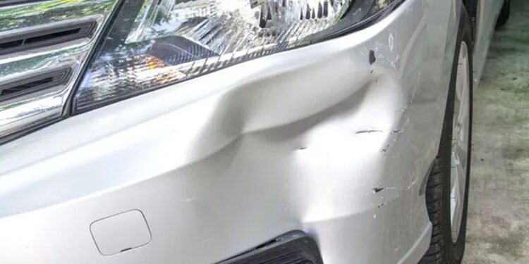 Address Dents on Your Personal Vehicle