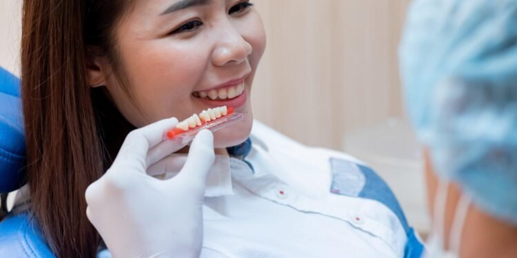 The Ultimate Guide to Partial Dentures