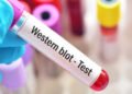 Western Blot Costs