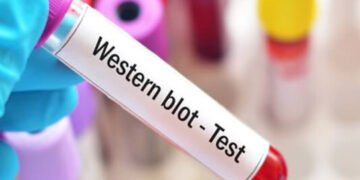 Understanding Western Blot Costs: A Comprehensive Overview - Mitmunk