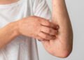 The Discomfort of Chafing Rash: A Closer Look