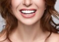 Smile Decisions: Harmony Veneers vs. Traditional Veneers – Which One’s Your Perfect Fit?