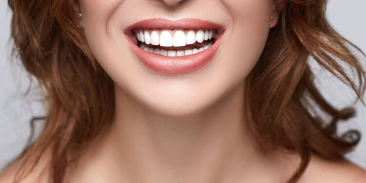 Smile Decisions: Harmony Veneers vs. Traditional Veneers – Which One’s Your Perfect Fit?