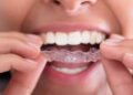Protecting Your Teeth from Everyday Wear and Tear