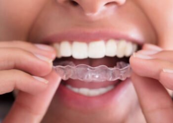 Protecting Your Teeth from Everyday Wear and Tear