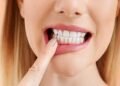 What-Your-Teeth-Say-About-You