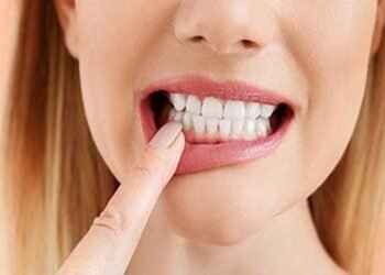 What-Your-Teeth-Say-About-You