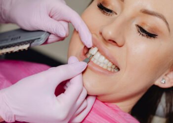 Smile Makeover in Brisbane: Combining Implants and Veneers for Best Results