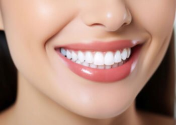 Secrets to a Perfect Smile from Top North York Dental Experts