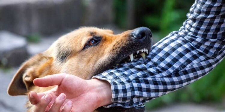 Steps to Take Immediately After a Dog Bite Injury