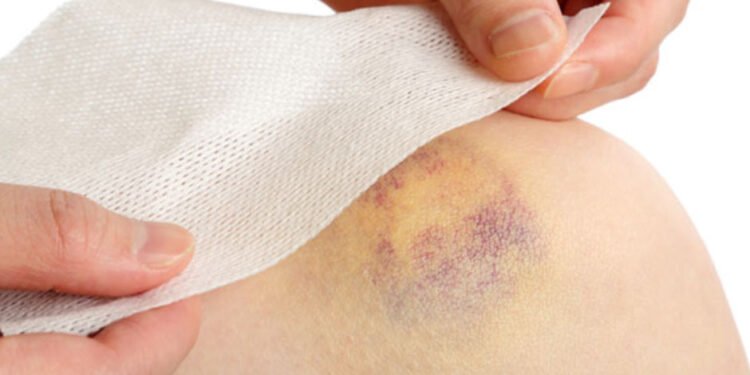 The Little-Known Nutrients That Protect Your Skin From Surgery Bruises