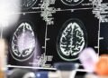 Why Investing in Advanced Imaging Equipment is a Key ROI Consideration for Business Leaders