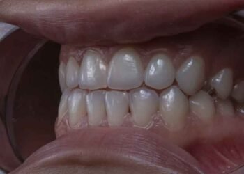 5 Fun Ways to Teach Kids Good Dental Habits