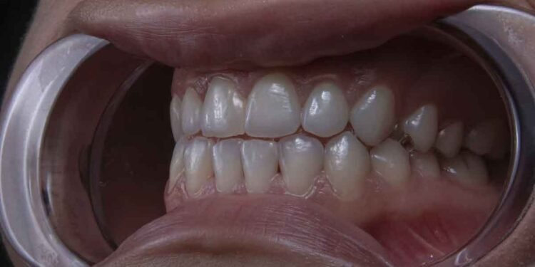 5 Fun Ways to Teach Kids Good Dental Habits