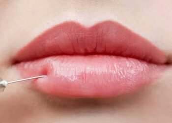 9 Reasons Non-Surgical Lip Enhancement Is Gaining Popularity
