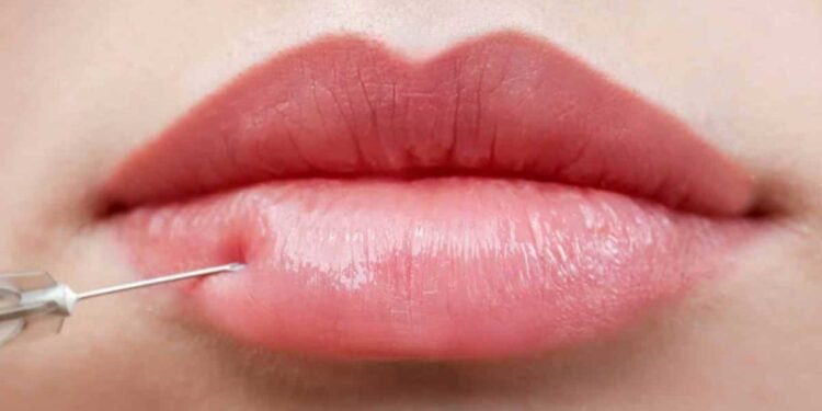 9 Reasons Non-Surgical Lip Enhancement Is Gaining Popularity
