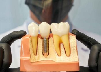 Achieving Natural Results With Modern Dental Techniques