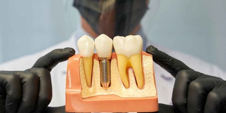 Achieving Natural Results With Modern Dental Techniques