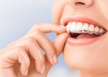 Invisalign Treatment: A Complete Guide to Straighter Teeth