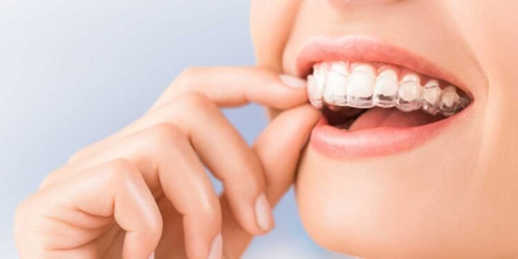 Invisalign Treatment: A Complete Guide to Straighter Teeth